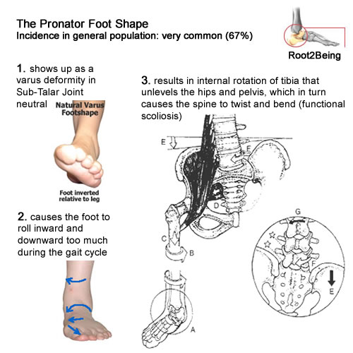 The pronator foot shape identifiers: varus deformity, hyperpronation and internal twisting of the lower limbs